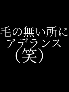 �т̖������� �A�f�����X �i�΁j    